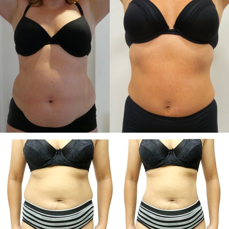 BVSA (14) Hexi Body Toner