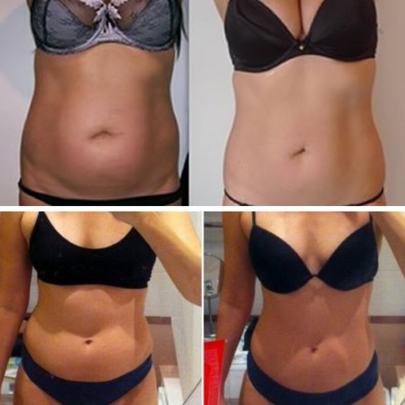 BVSA (16) Hexi Body Toner