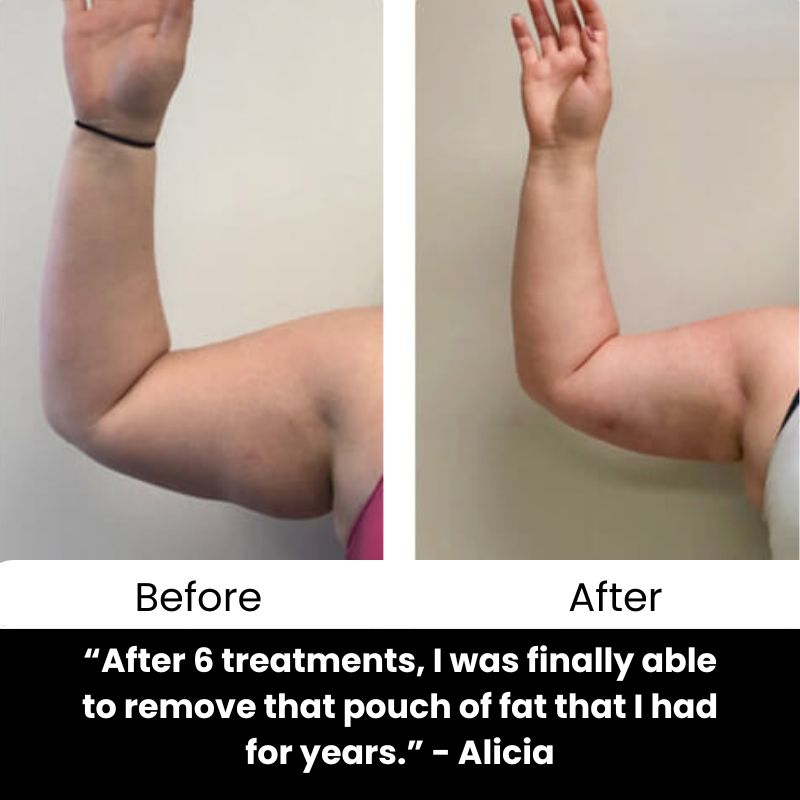 BVSA (19) Hexi Body Toner